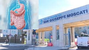 AVELLINO, EFFETTUATO CON SUCCESSO INTERVENTO COMBINATO ENDOSCOPICO E CHIRURGICO ALL’AVANGUARDIA.