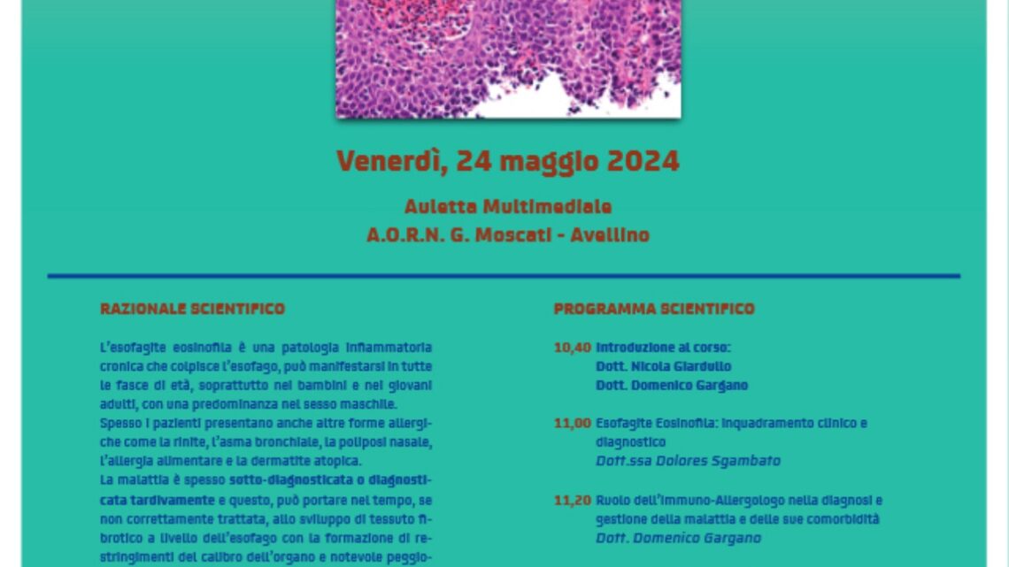 Esofagite eosinofila: all’Azienda Moscati Esofagite eosinofila: all’Azienda Moscati