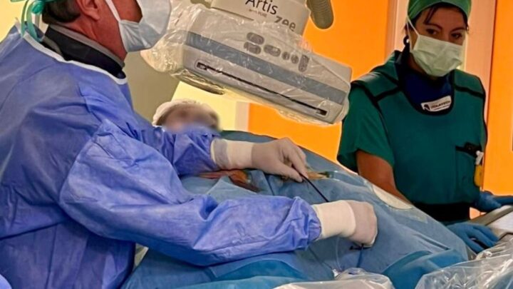 Ariano Irpino, intervento salvavita al “Frangipane – Bellizzi”: eseguita la prima embolectomia polmonare meccanica con tromboaspirazione manuale in Italia