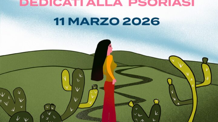 Open day psoriasi promosso da Onda: all’ospedale Landolfi di Solofra un 11 marzo di visite e consulenze gratuite